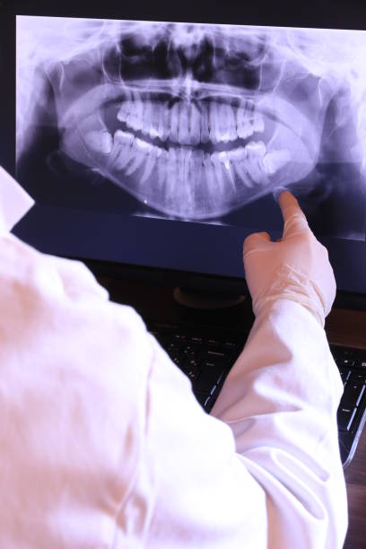 Best Emergency Tooth Extraction in National City, CA