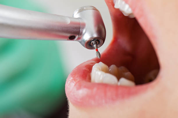 Best Emergency Orthodontic Repairs in National City, CA